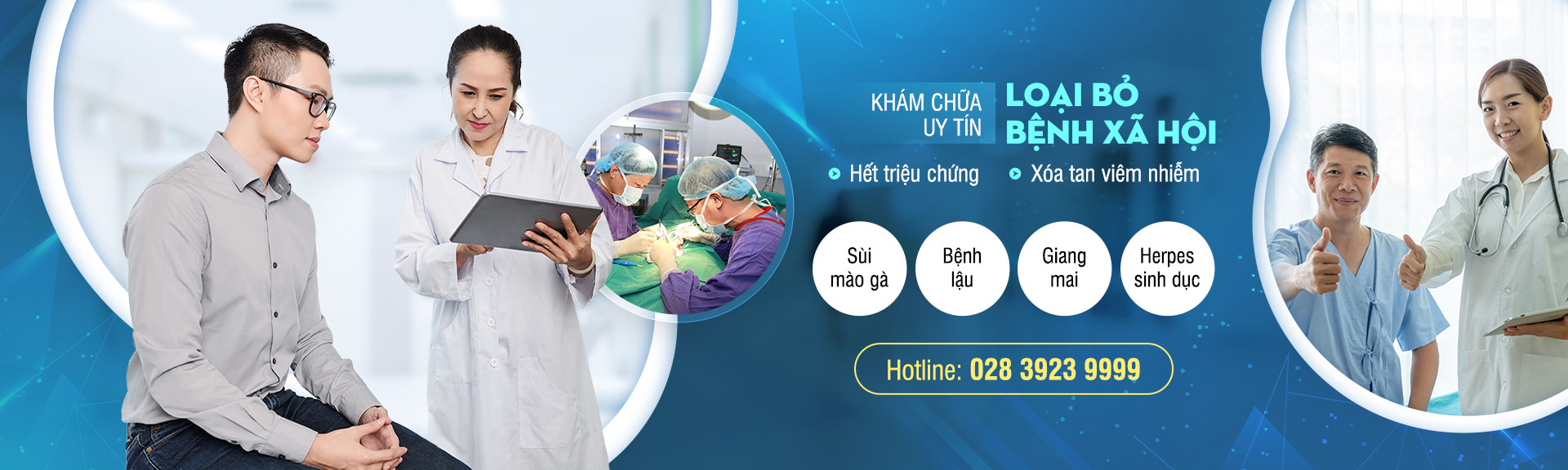 Điều trị sùi mào gà tại tphcm
